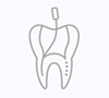 Nonsurgical Root Canal Treatment
